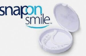 snap on smile 1 e1687389760781